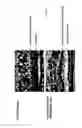 Fig. 07 - Transplantation of cells expressing markers for photoreceptor cells and retinal ganglion cells induced from Müller stem cells