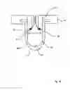 Fig. 49 - Apparatuses and methods for manufacturing containers