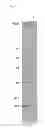 Fig. 06 - Maltotriosyl transferase and use thereof