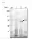 Fig. 08 - Maltotriosyl transferase and use thereof
