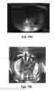 Fig. 28 - CONTROL OF BUBBLE SIZE IN A CARBONATED LIQUID