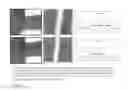 Fig. 07 - MICROMETRIC DIRECT-WRITE METHODS FOR PATTERNING CONDUCTIVE MATERIAL AND APPLICATIONS TO FLAT PANEL DISPLAY REPAIR