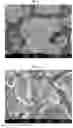 Fig. 02 - Cathode active material and secondary battery comprising the same