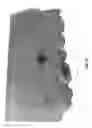 Fig. 06 - ORTHODONTIC ANCHORING SCREW AND PROCESS FOR MAKING IT