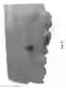 Fig. 07 - ORTHODONTIC ANCHORING SCREW AND PROCESS FOR MAKING IT