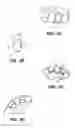 Fig. 03 - PREFORMED PROVISIONAL CROWNS AND METHODS FOR CONSTRUCTING TEMPORARY DENTAL CROWNS AND BRIDGES