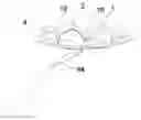 Fig. 01 - METHOD OF FORMING A DENTAL MATRIX