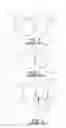 Fig. 02 - METHOD OF FORMING A DENTAL MATRIX