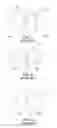 Fig. 04 - METHOD OF FORMING A DENTAL MATRIX