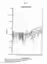 Fig. 04 - Method for detection of human papillomavirus (HPV) type