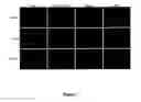Fig. 13 - DEVICE FOR CAPTURE, ENUMERATION, AND PROFILING OF CIRCULATING TUMOR CELLS