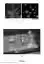 Fig. 05 - SERUM-FREE MEDIUM FOR INDUCING PLURIPOTENT STEM CELLS QUICKLY WITH HIGH EFFICIENCY AND METHOD USING THEREOF