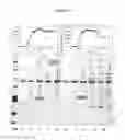 Fig. 34 - PHOSPHOLIPASES, NUCLEIC ACIDS ENCODING THEM AND METHODS FOR MAKING AND USING THEM