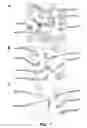 Fig. 09 - Crystals of membrane proteins