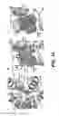 Fig. 15 - Crystals of membrane proteins