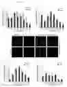 Fig. 16 - METHODS AND COMPOSITIONS FOR GENERATING SELF ATTENUATING GENETIC CIRCUITRY