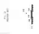 Fig. 02 - METHOD OF MANUFACTURING TMV PACKAGE-ON-PACKAGE DEVICE