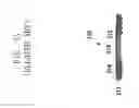Fig. 05 - METHOD OF MANUFACTURING TMV PACKAGE-ON-PACKAGE DEVICE