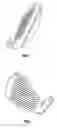 Fig. 06 - Golf club head with top line insert