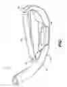 Fig. 10 - Golf club head with top line insert