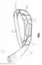 Fig. 13 - Golf club head with top line insert