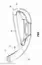 Fig. 14 - Golf club head with top line insert