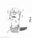 Fig. 05 - Ball-hitting glove assembly for boxing training
