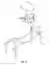Fig. 03 - SLIDING ABDOMINAL EXERCISE DEVICE