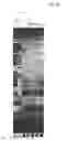 Fig. 12 - METHOD OF DIAGNOSING BLADDER CANCER