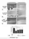 Fig. 12 - Method and medication for prevention and treatment of ocular hypertension and glaucoma