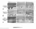 Fig. 13 - Method and medication for prevention and treatment of ocular hypertension and glaucoma