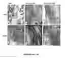 Fig. 14 - Method and medication for prevention and treatment of ocular hypertension and glaucoma