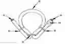 Fig. 01 - Adjustable tourniquet for venous flow control