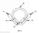 Fig. 04 - Adjustable tourniquet for venous flow control