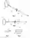 Fig. 03 -  Implantable system, a device for inserting the implantable system and a  method thereof