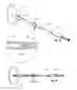 Fig. 07 -  Implantable system, a device for inserting the implantable system and a  method thereof