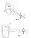 Fig. 09 -  Implantable system, a device for inserting the implantable system and a  method thereof