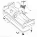 Fig. 13 -  Implantable system, a device for inserting the implantable system and a  method thereof