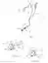 Fig. 02 - ENDOSCOPIC SYSTEM WITH FLUID CLEANING