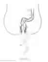 Fig. 08 - ENDOSCOPIC SYSTEM WITH FLUID CLEANING