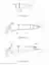 Fig. 09 - ENDOSCOPIC SYSTEM WITH FLUID CLEANING