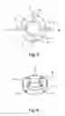 Fig. 05 - SURGICAL ACCESS DEVICE SYSTEM AND METHODS OF USE