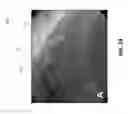 Fig. 28 - Methods and systems for determining vascular bodily lumen information and guiding medical devices