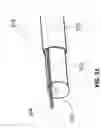 Fig. 35 - Methods and systems for determining vascular bodily lumen information and guiding medical devices