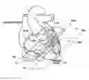 Fig. 01 - Medical image diagnosis assisting apparatus, method, and program