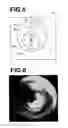 Fig. 05 - Medical image diagnosis assisting apparatus, method, and program