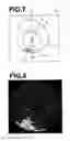 Fig. 06 - Medical image diagnosis assisting apparatus, method, and program