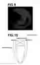 Fig. 07 - Medical image diagnosis assisting apparatus, method, and program
