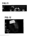 Fig. 08 - Medical image diagnosis assisting apparatus, method, and program