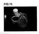 Fig. 11 - Medical image diagnosis assisting apparatus, method, and program